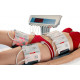 Аппарат холодного лазерного липолиза Lipobeltlaser